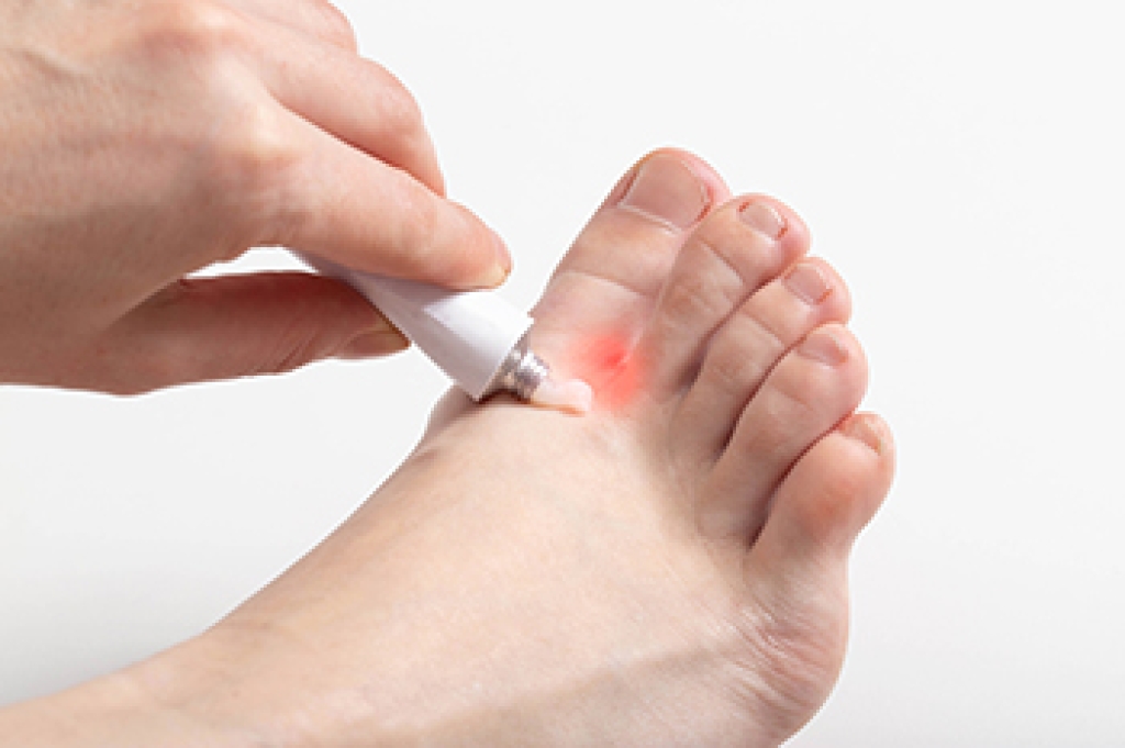 Red Spots on the Feet