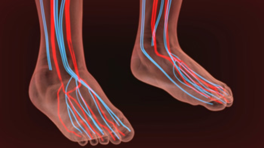 Peripheral Vascular Disease and Foot Health