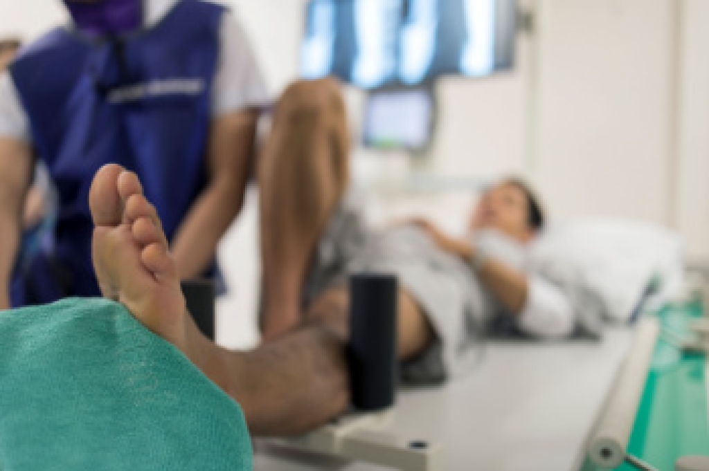Foot Stress Fractures From Running