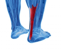 Possible Causes of Injuries That Affect the Achilles Tendon