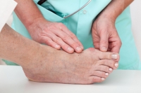 What is a Bunion?