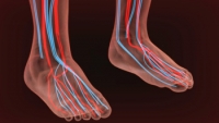 What Can Cause Poor Circulation in Feet?